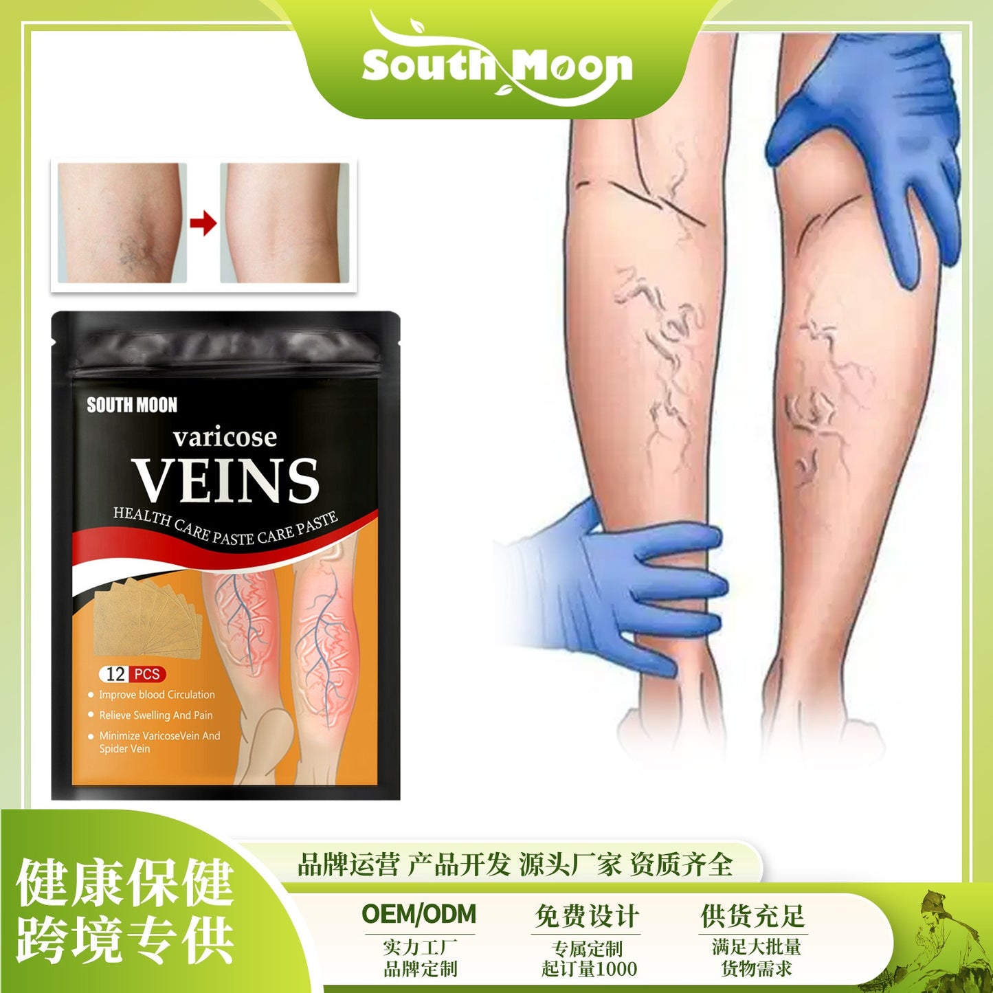 Venous health patch relieves varicose blood vessel blockage and protrusions in the feet. Cold compress venous health patch